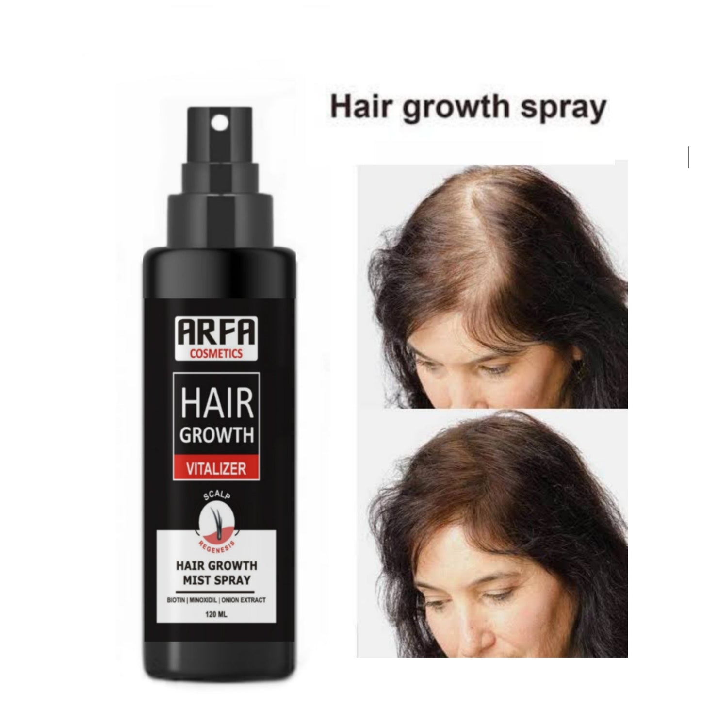 Hair Growth Spray 120ML